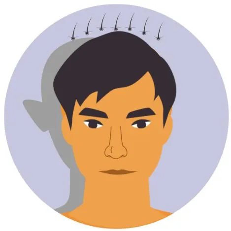 Hair Transplantation