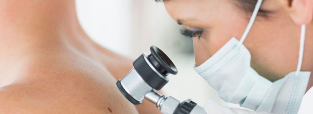 upper eyelid surgery in Bangalore