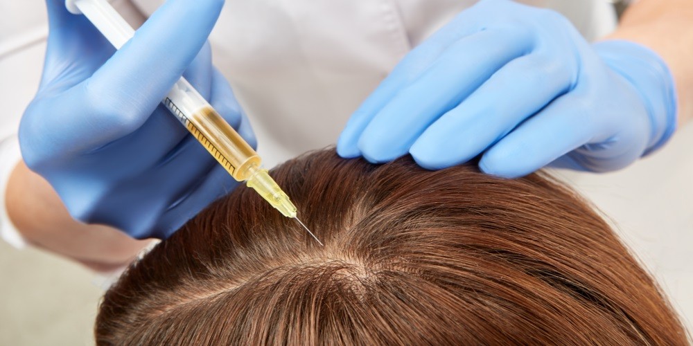 upper eyelid surgery in Bangalore